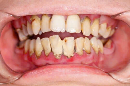  Tin tức - Sự kiện mới